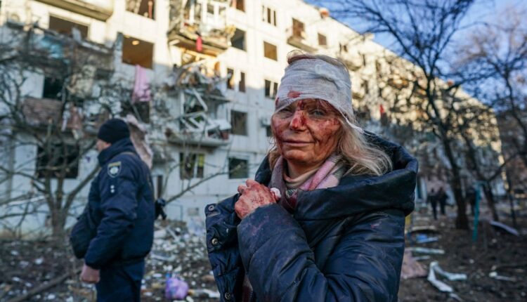 Một phụ nữ bị thương sau cuộc không kích tại một khu chung cư ở thành phố Chuhuiv, tỉnh Kharkiv, Ukraine vào ngày 24/2. (Ảnh: Wolfgang Schwan/Getty Images)