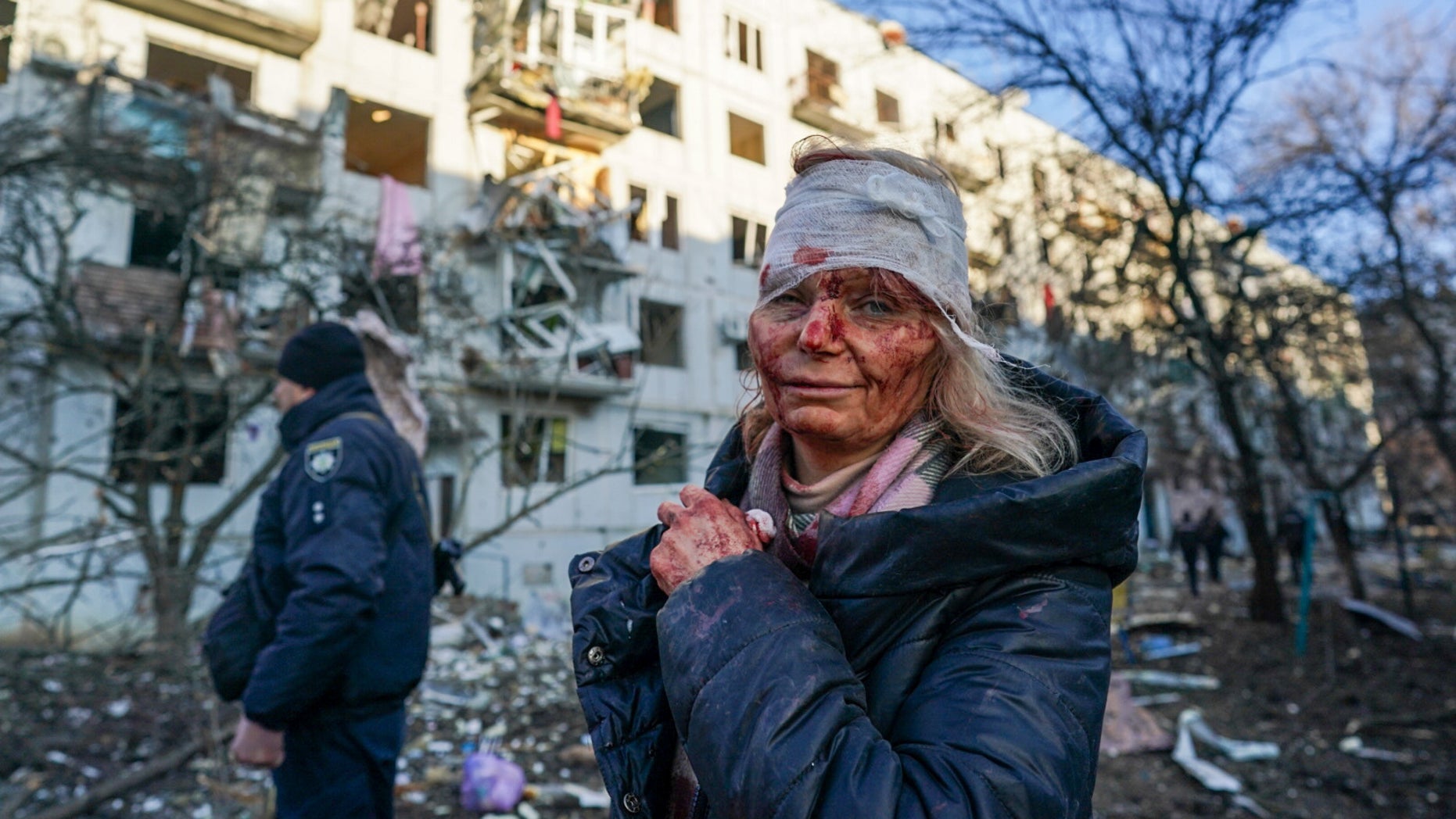 Một phụ nữ bị thương sau cuộc không kích tại một khu chung cư ở thành phố Chuhuiv, tỉnh Kharkiv, Ukraine vào ngày 24/2. (Ảnh: Wolfgang Schwan/Getty Images)